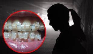 Toruń. Zakładał aparaty po "promocyjnej cenie". Zgotował piekło kilkudziesięciu osobom