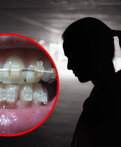 Toruń. Zakładał aparaty po "promocyjnej cenie". Zgotował piekło kilkudziesięciu osobom