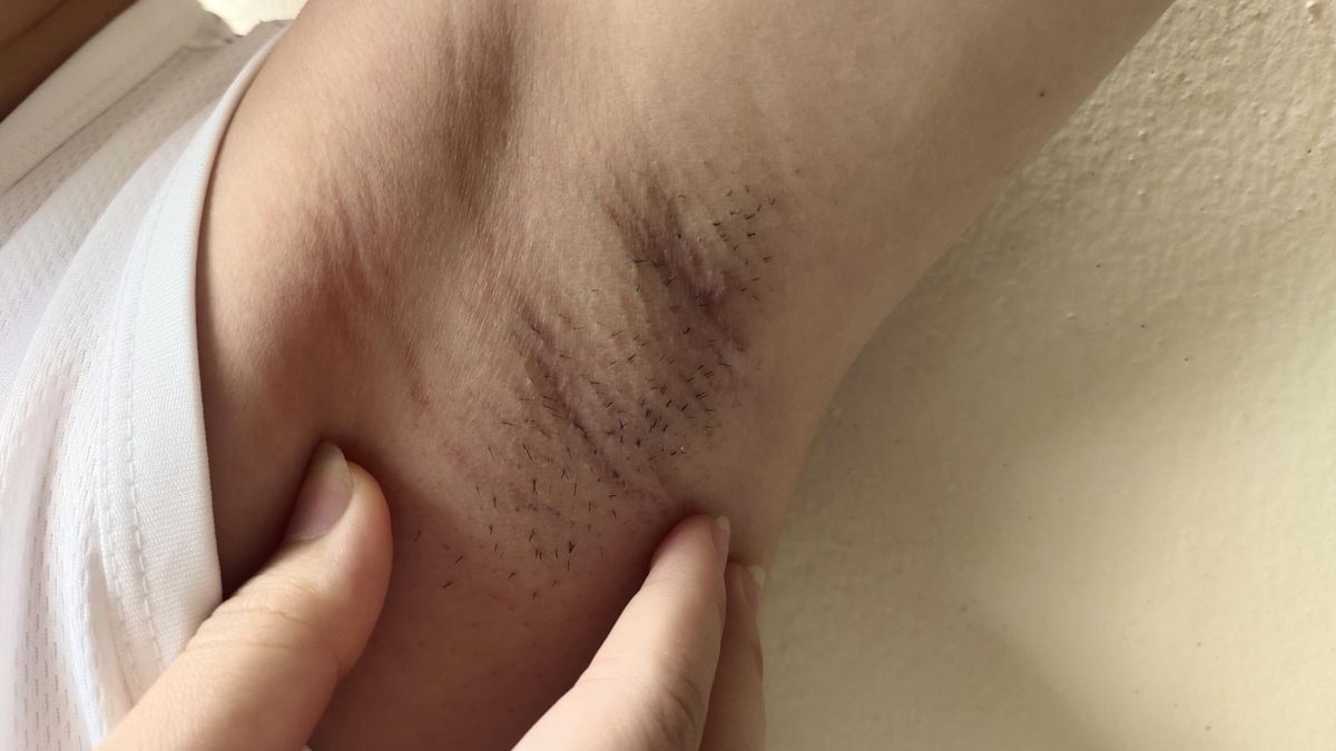 Sucha, łuszcząca się, popękana skóra może być objawem groźnej choroby