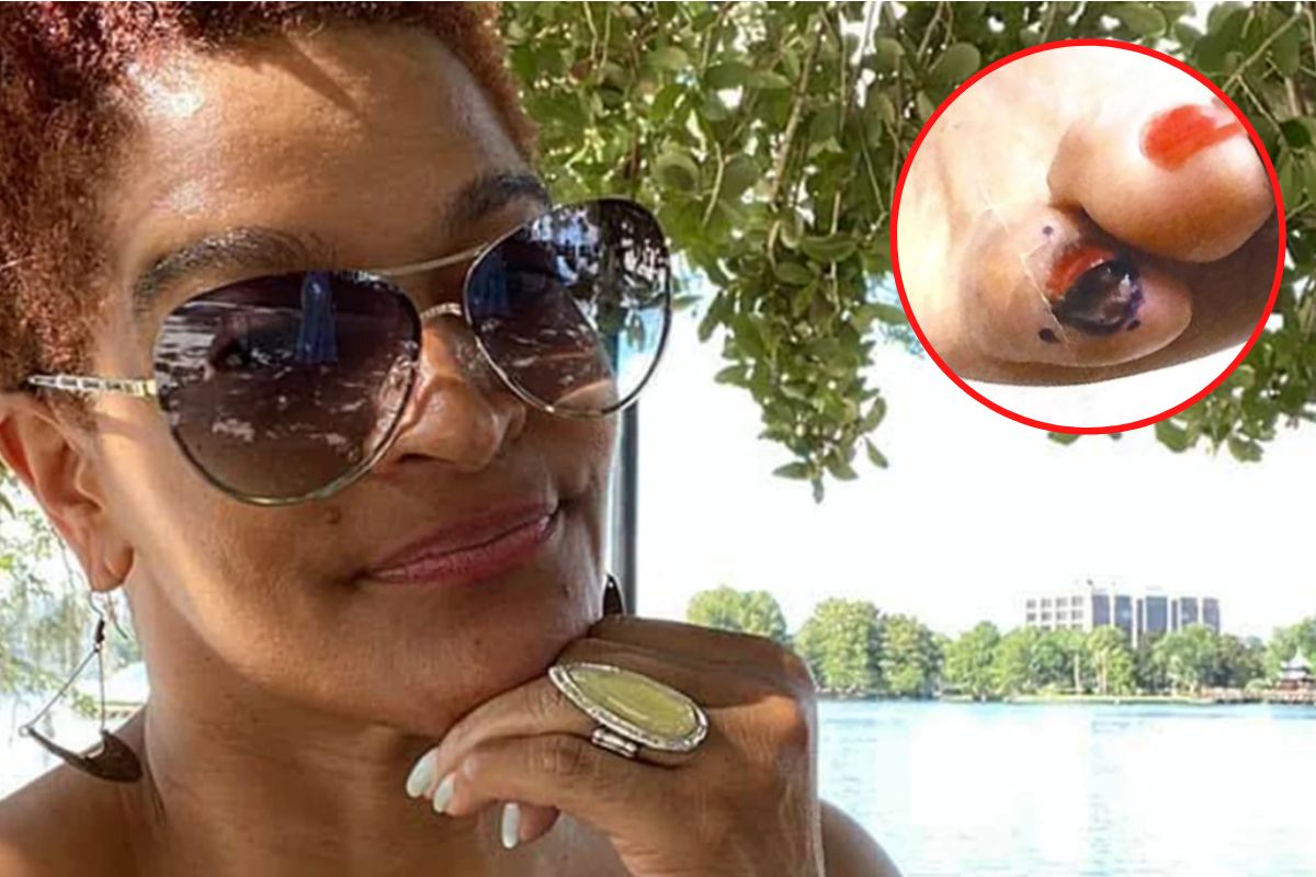 Odkryła małą plamkę pod paznokciem. Nie mogła uwierzyć, że to rak skóry