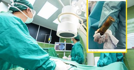 88-latek zgłosił się z nietypowym problemem. Lekarze nie mogli uwierzyć