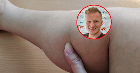 Tak unikniesz zakrzepicy w podróży. "Nie bagatelizuj tego problemu"
