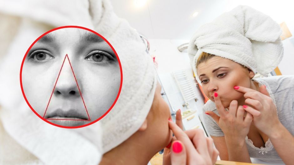 Trójkąt śmierci na twarzy, czyli dlaczego nie należy wyciskać pryszczy w tym obszarze