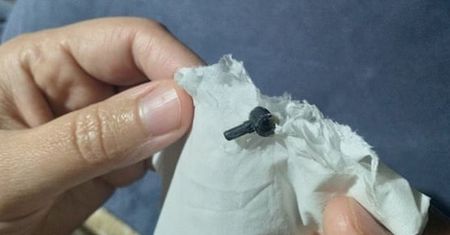 Chłopiec włożył Lego do nosa. Zabawka wypadał dwa lata później