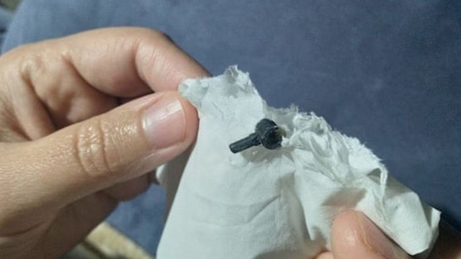 Lego utkwiło w nosie dziecka