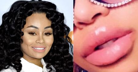 Blac Chyna chwali się monstrualnymi wargami. Internauci: "OBRZYDLIWE. Nigdy nie będziesz miała klasy!"