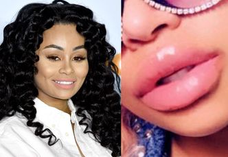 Blac Chyna chwali się monstrualnymi wargami. Internauci: "OBRZYDLIWE. Nigdy nie będziesz miała klasy!"