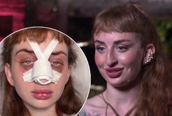 W "Hotelu Paradise" ją skrytykowano. Wyszła i "zrobiła" sobie nos