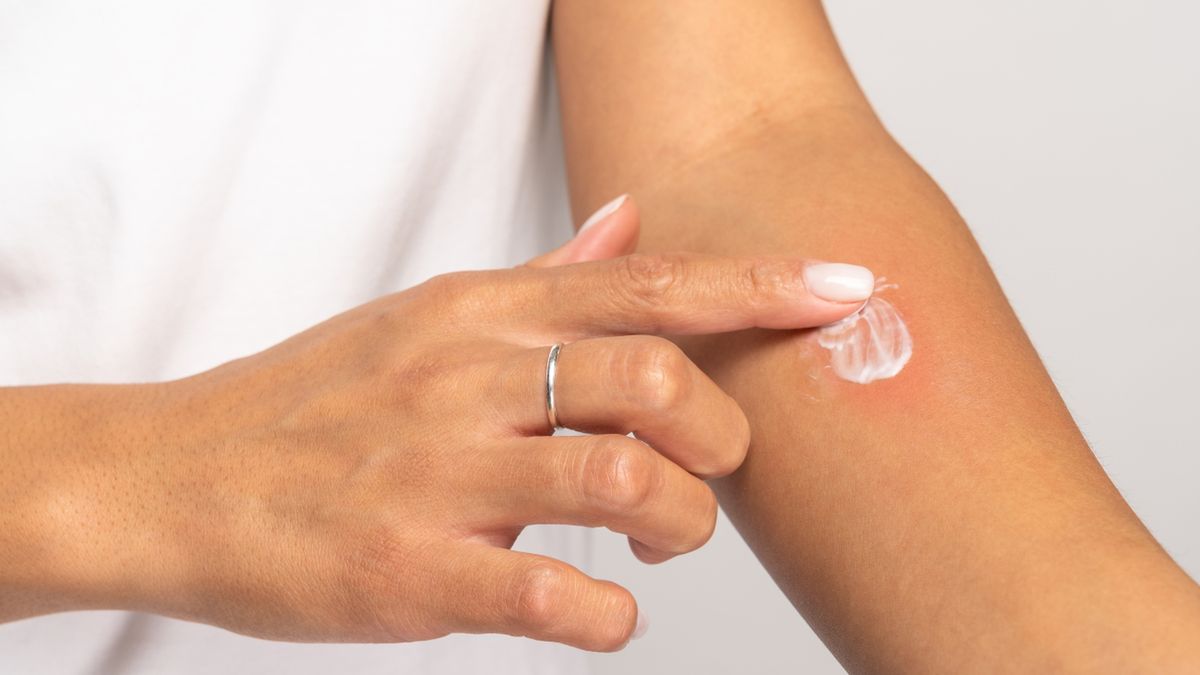 Dermilen pomaga na problemy takie jak łuszczyca, czy egzema