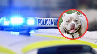 Amstaff zaatakował kobietę w Płocku. "Właściciel pod wpływem alkoholu"