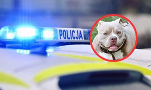 Amstaff zaatakował kobietę w Płocku. "Właściciel pod wpływem alkoholu"