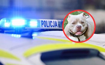 Amstaff zaatakował kobietę w Płocku. "Właściciel pod wpływem alkoholu"