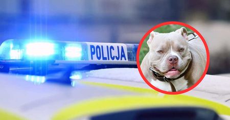 Amstaff zaatakował kobietę w Płocku. "Właściciel pod wpływem alkoholu"