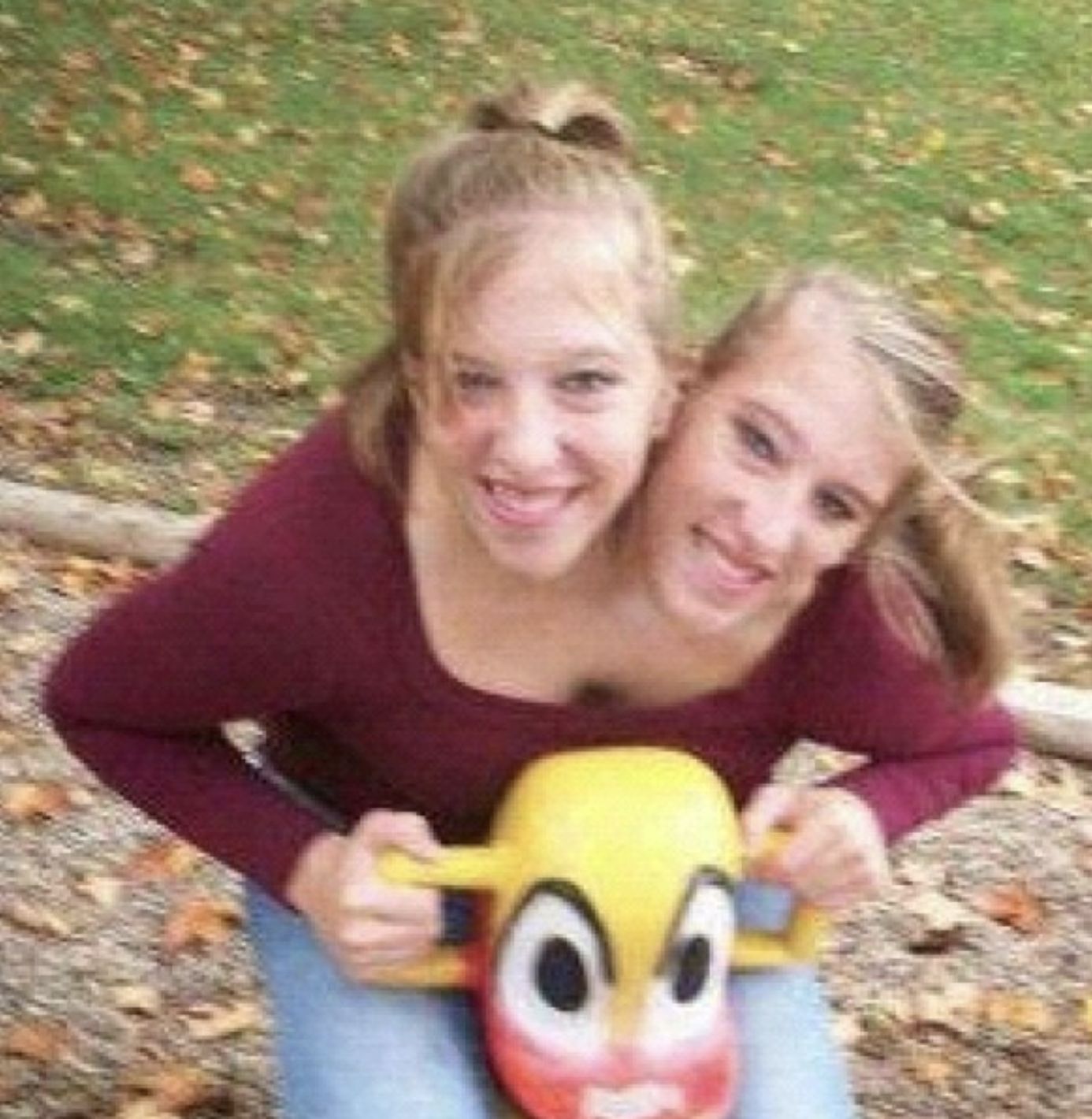 Abby i Brittany Hensel