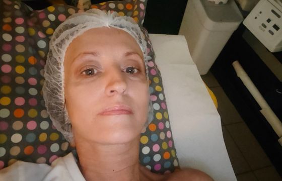 Tak wyglądała walka o życie Agnieszki Burzyńskiej. "Lekarze mówią o cudzie"