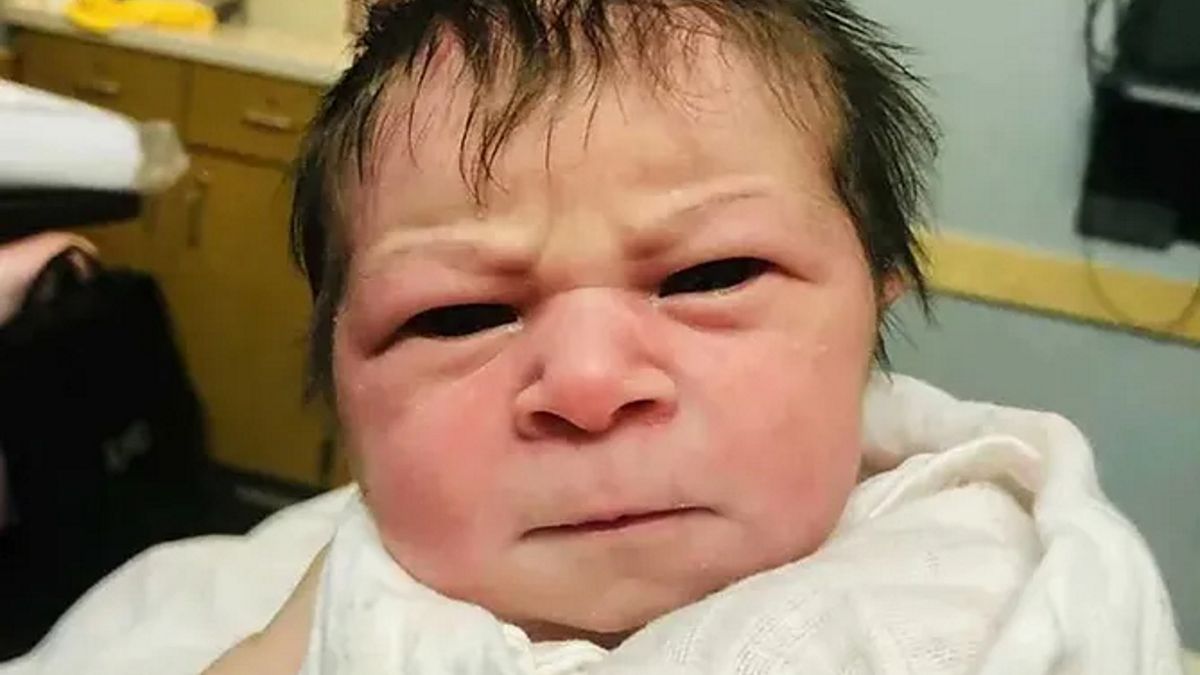 Była w szoku, gdy pierwszy raz zobaczyła syna. "Mam nadzieję, że jego twarz się zmieni".