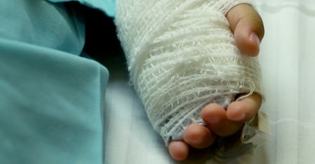 Dwulatek poparzył się ulicznymi halogenami. Ból i cierpienie wyceniono na 300 zł