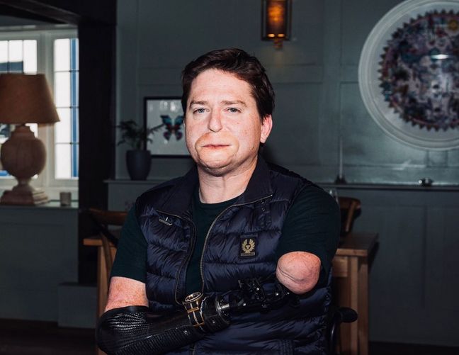 Alex Lewis cudem uniknął śmierci