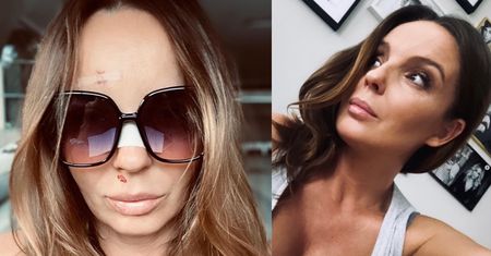 Agnieszka Włodarczyk ujawnia, jak się czuje po wypadku: "Miałam dziś OPERACJĘ"