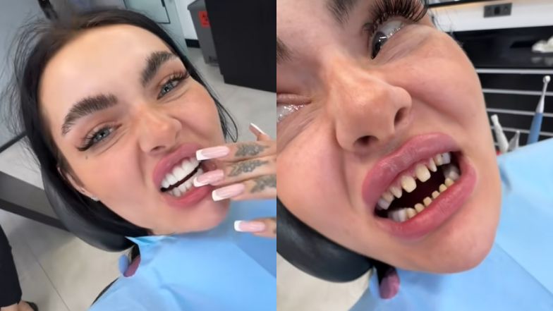 Zusje znów poprawiła sobie zęby