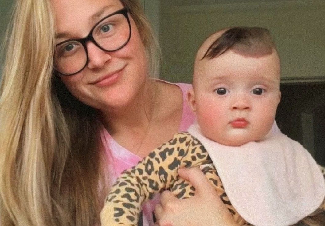 New Zealand girl born with unique "unicorn horn" birthmark draws attention