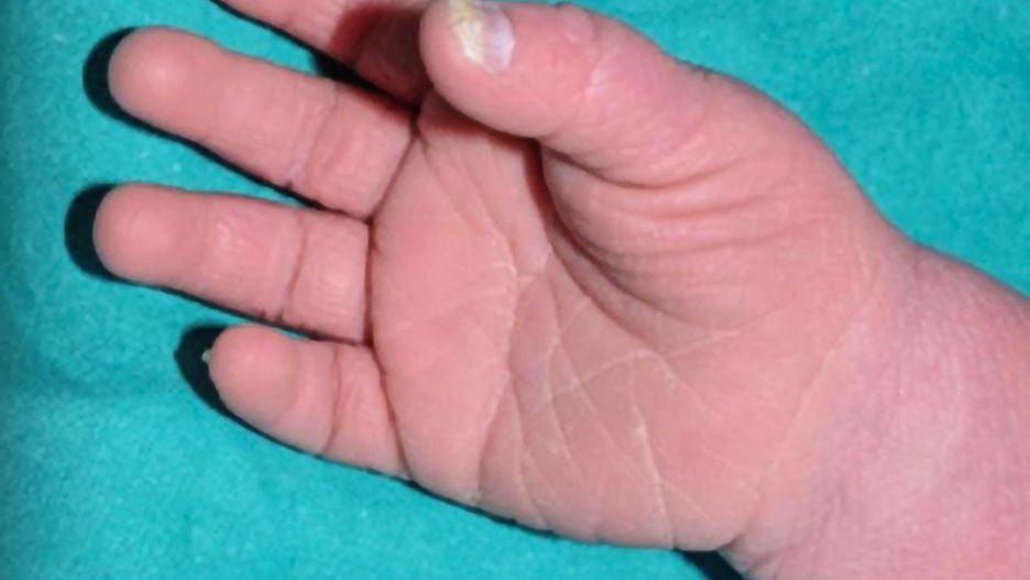 Rączka 9-miesięcznej dziewczynki