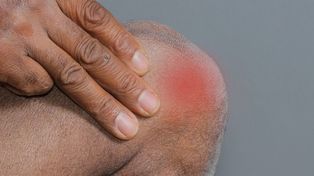 Artroza: Unikaj intensywnych treningów