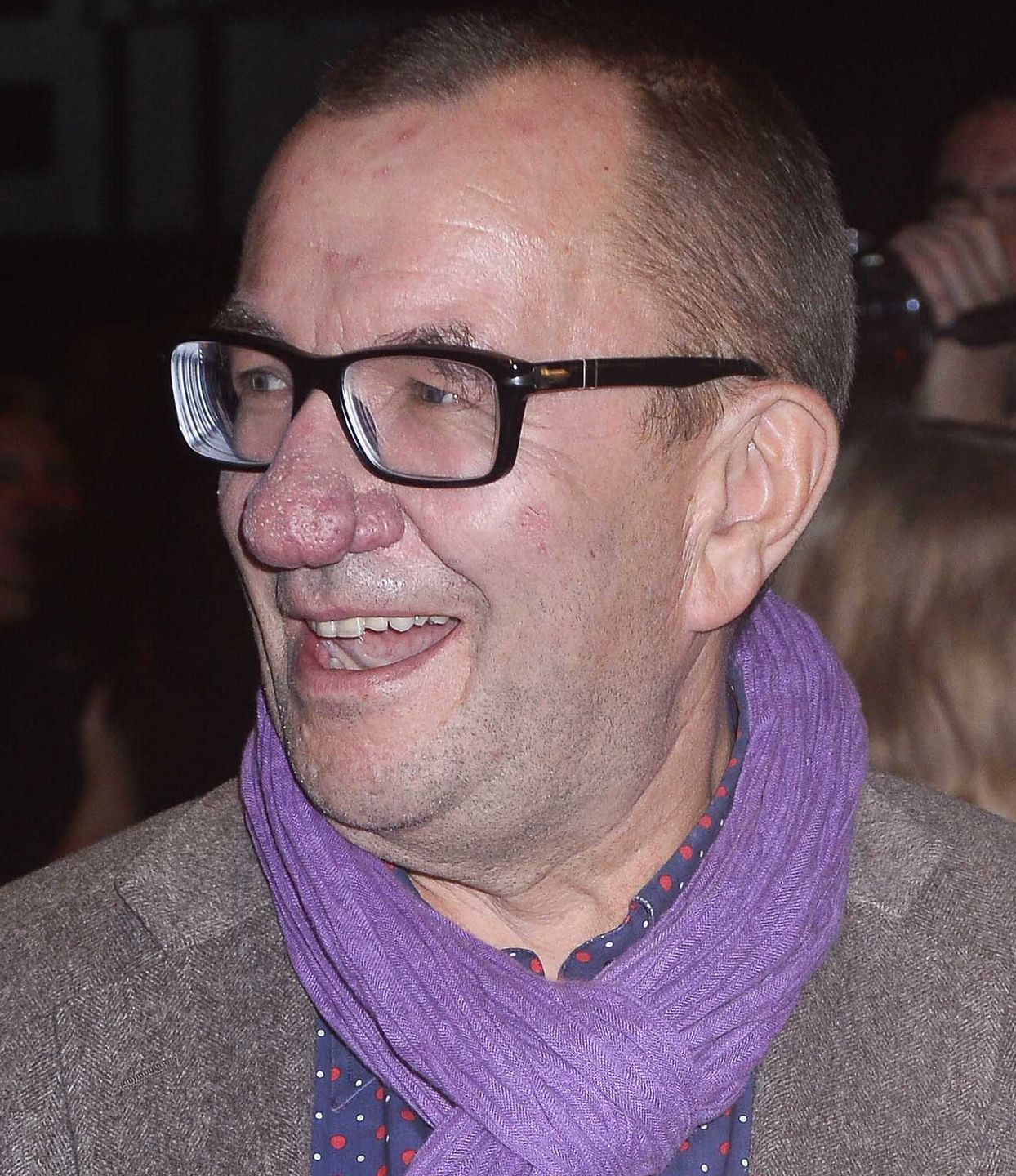 Nos Rafała Bryndala przed operacją