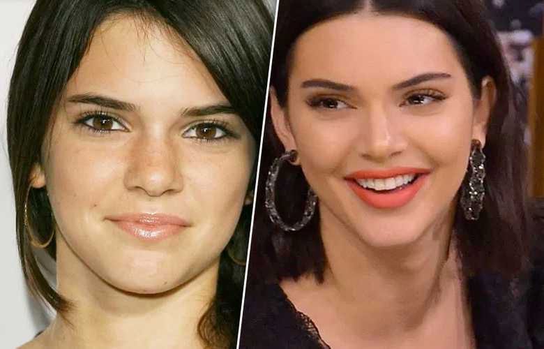 Kendall Jenner – nos