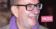 Dumny Rafał Bryndal pochwalił się nowym nosem w "Dzień Dobry TVN"! Po operacji wygląda perfekcyjnie!