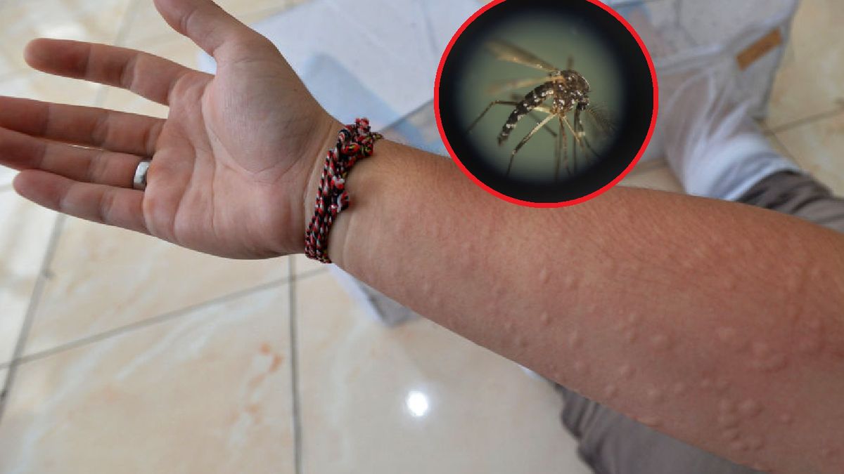 Ponad trzykrotny wzrost przypadków. W Polsce atakuje choroba przenoszona przez komary