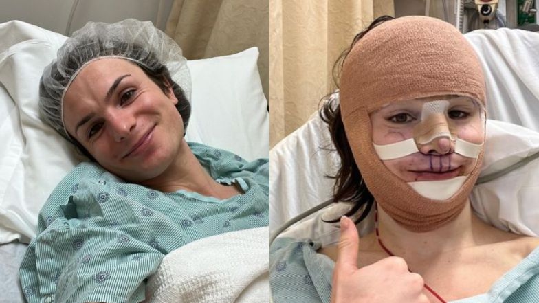 Transpłciowa tiktokerka pokazała, jak wygląda po operacji feminizacji twarzy