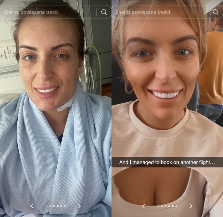 Tiktokerka Amanda Turner zafundowała sobie "tureckie zęby"