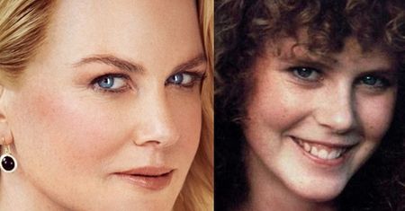 Gładka twarz Nicole Kidman w "Vogue'u"...