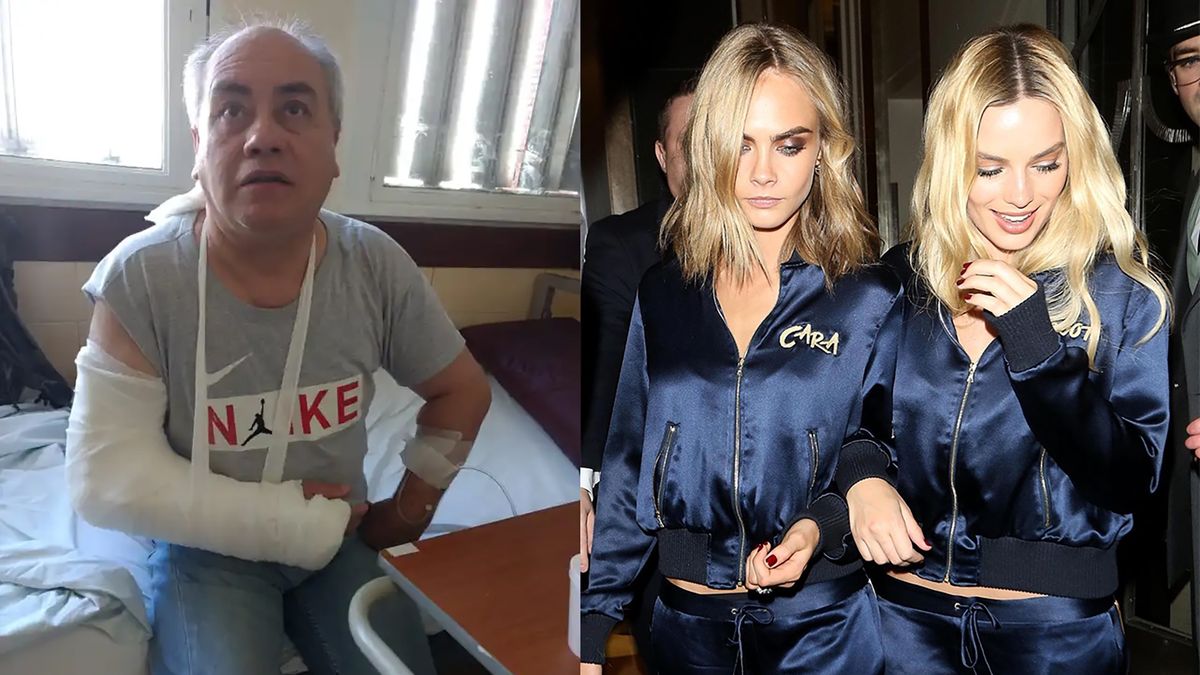 Fotograf martwi się o przyszłość swojej ręki po spotkaniu z przyjaciółmi aktorek.