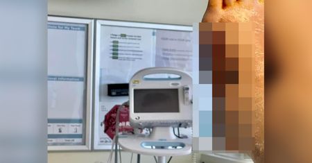 Może stracić nogę. Powodem jest bezmyślne selfie