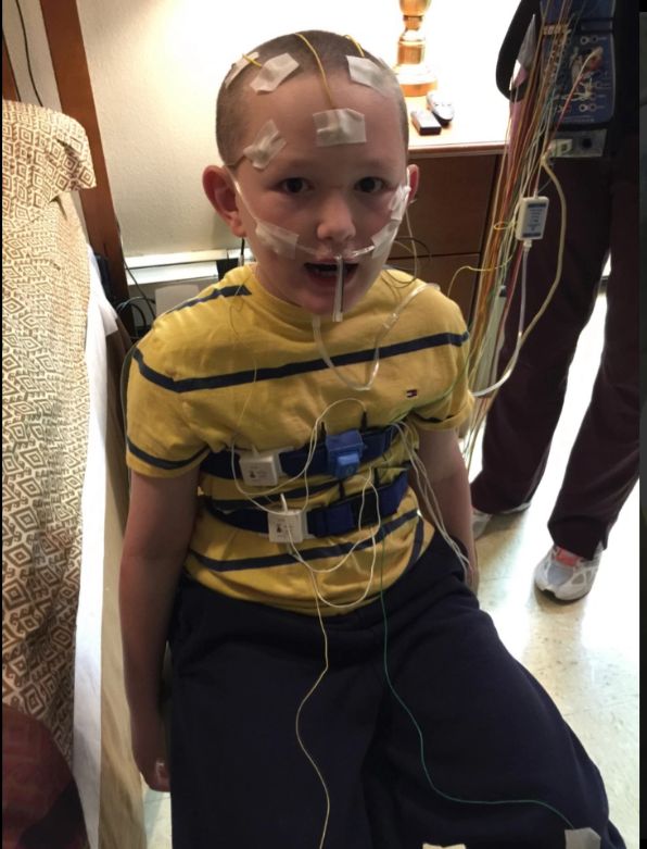 Zespół sztywnienia skóry to rzadka choroba atakująca dzieci tuż po urodzeniu lub we wczesnym dzieciństwie