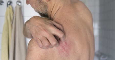 Pierwsza taka terapia. FDA zatwierdziła przełomowy lek na łuszczycowe zapalenie stawów