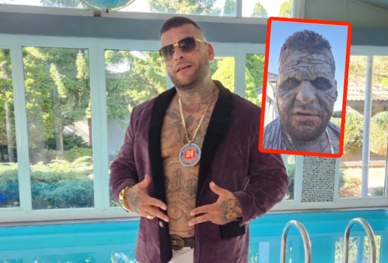 Popek Prawdziwa Dama To Twoja Mama "Popek" przeraził swoich fanów. Tylko spójrz na jego twarz - o2