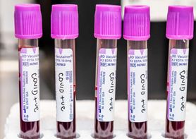 Koronawirus. Grupa krwi "A" zwiększa ryzyko zachorowania na COVID-19. Nowe badania