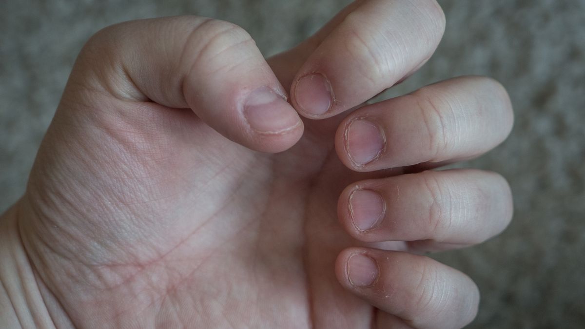 Gdy zauważysz ten objaw, pędź do hepatologa