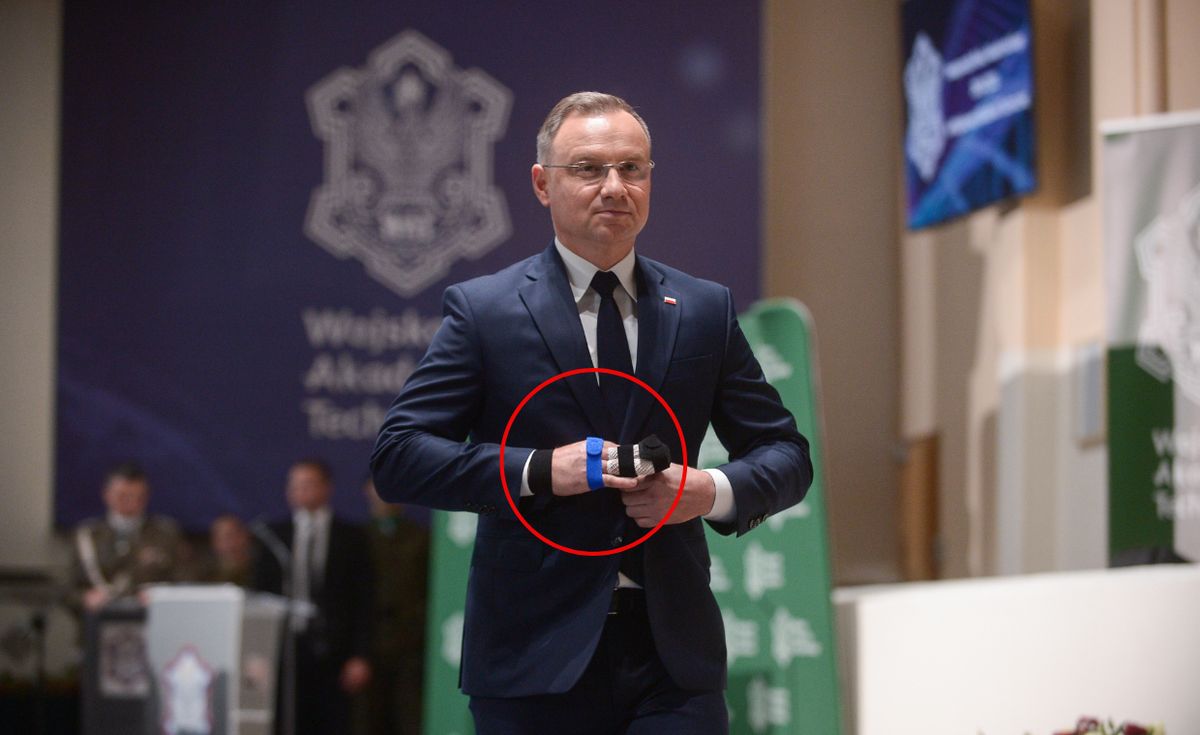 Andrzej Duda doznał kontuzji