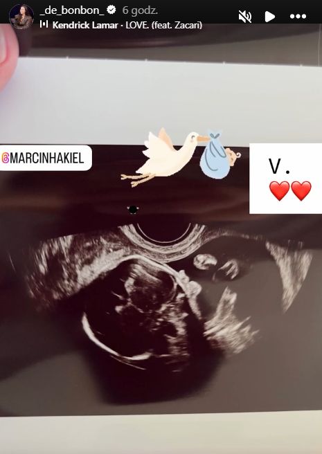Dominika Serowska pokazuje zdjęcie USG