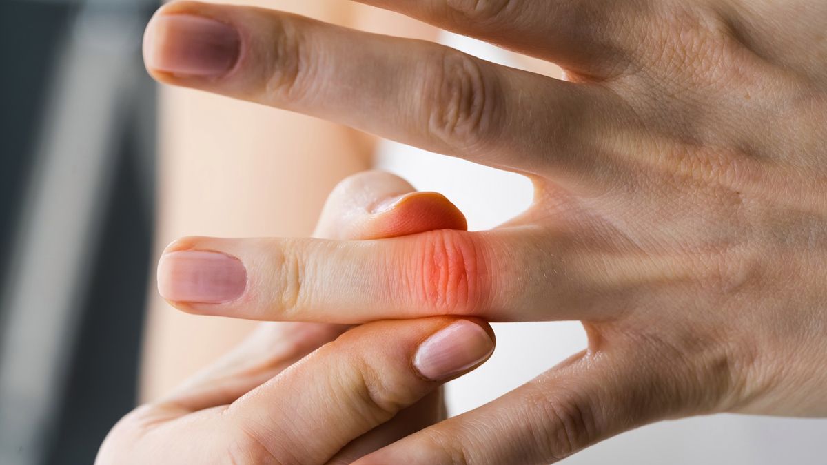 Drętwienie palców – przyczyny, leczenie