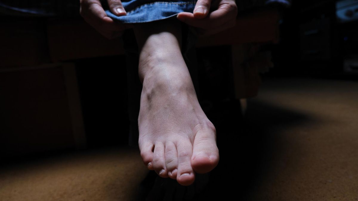 Zimne stopy mogą świadczyć o chorobie. Prosty test ujawni stan ukrwienia tkanek