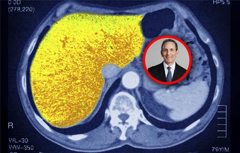 Wpływ leków GLP-1 na wątrobę. Ciekawe odkrycie