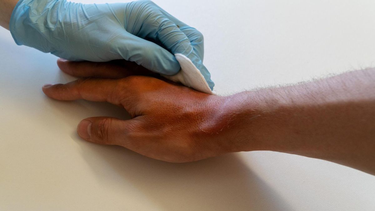 Stany zapalne skóry stanowią największą i najbardziej złożoną grupę chorób skóry.