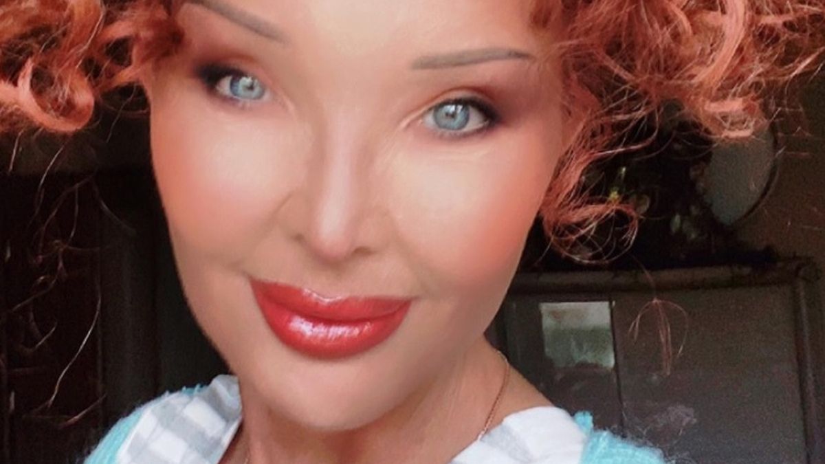 Ewa Minge opowiedziała o nieudanym zabiegu 