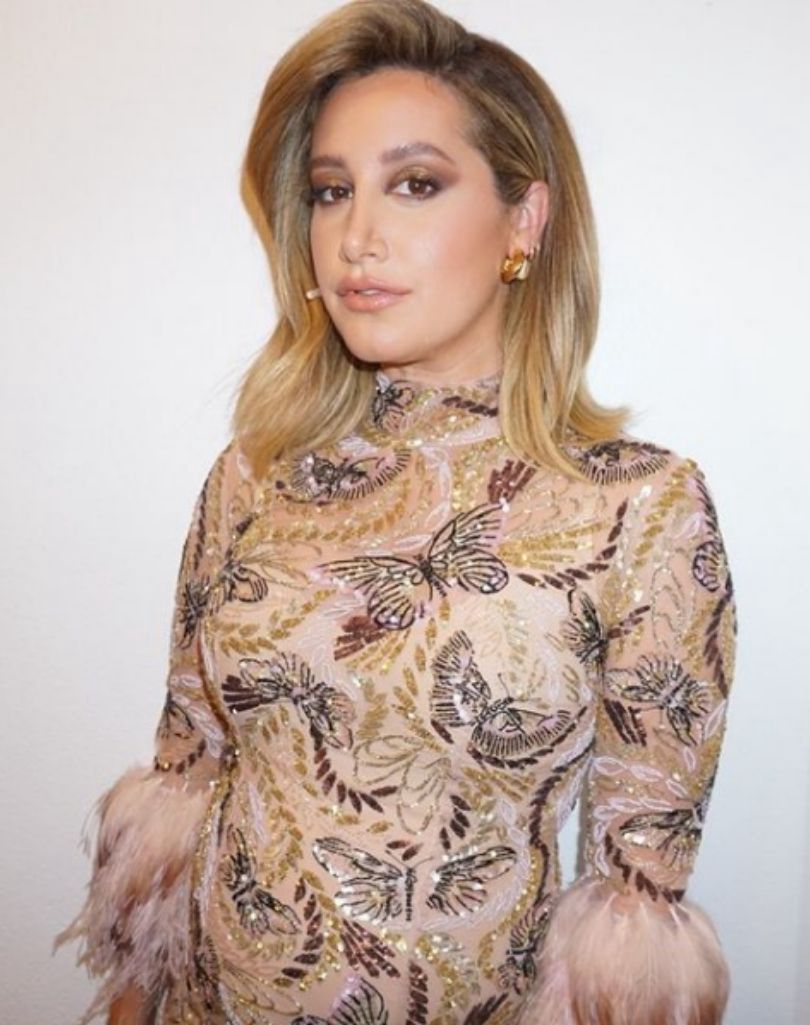 Ashley Tisdale z "High School Musical" wspomina negatywne komentarze po operacji nosa