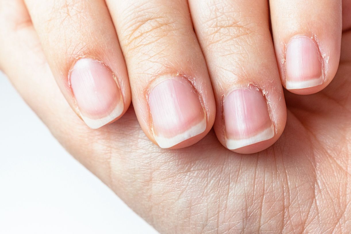 Symptoms of cancer can appear on the nails.